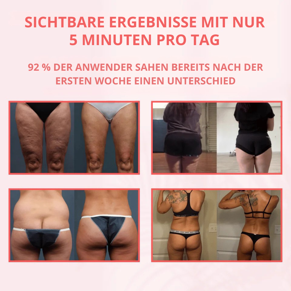 CelluSculpt™ | 4-in-1 Massagegerät mit Schröpfen, Infrarot & Wärme – reduziert Cellulite und Dehnungsstreifen sichtbar