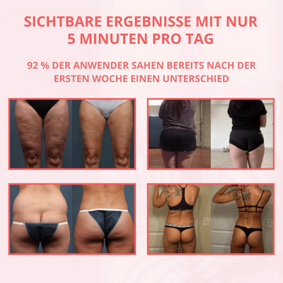 CelluSculpt™ | 4-in-1 Massagegerät mit Schröpfen, Infrarot & Wärme – reduziert Cellulite und Dehnungsstreifen sichtbar